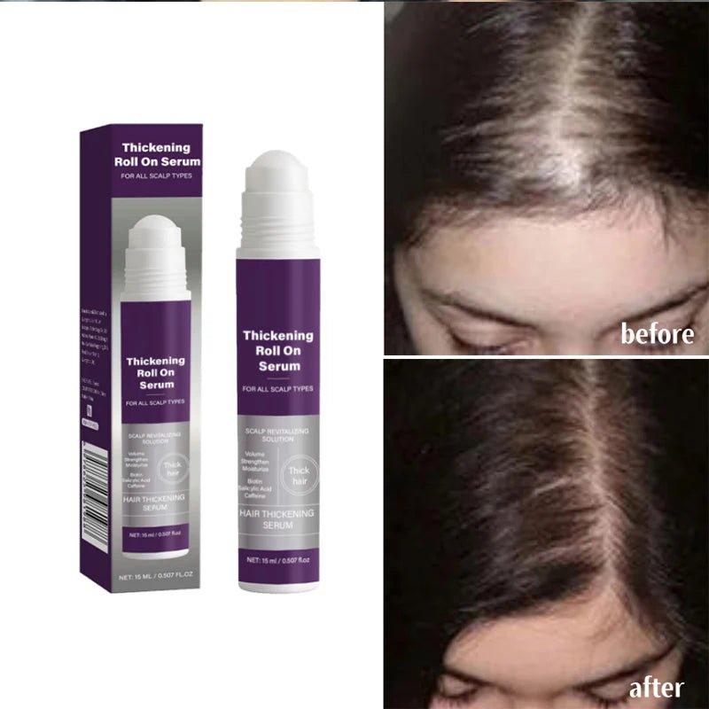 Volumising Scalp Serum Roll - On — Moisture & Oil Balance Hair Treatment - Hair Treatment | BodyForce UK